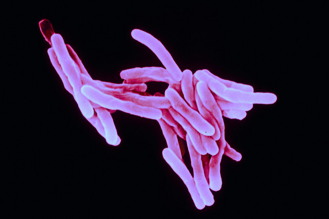 Возбудитель туберкулеза – бактерия Mycobacterium tuberculosis