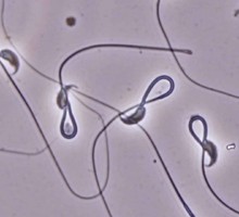 Воздействие микропластика ударило по качеству спермы