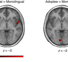 Мозг и социальное поведение