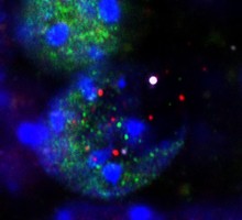 Формирование воспоминаний повреждает ДНК и вызывает воспаление мозга